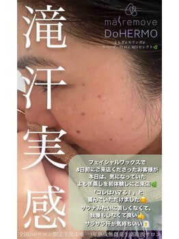 エリス(ELISSE)/よもぎ蒸しで滝汗実感