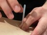 【顔鍼＋鍼灸マッサージ（全身施術）】30分＋65分計95分1400円割引