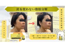 ティー(T)/レモンボトル