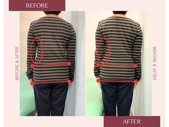 浦安駅前鍼灸整体院/before&after