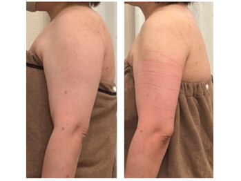 ミント(Mint)/2ヶ月半の変化　まだまだ継続中