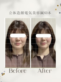 サロン ド ハリッシュ(Salon de HARISH)/