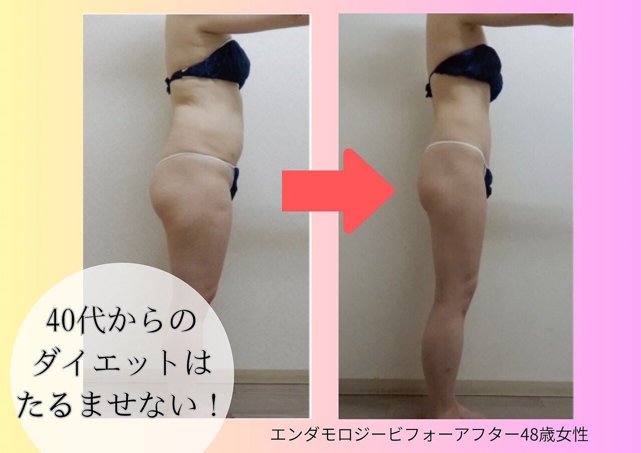 川崎市中原区でエンダモロジーが人気のエステサロン｜ホットペッパー