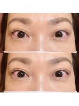 グラッディ(Glady)/まつ毛パーマ