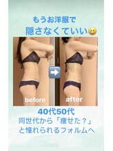 サロン ド プリヴェ(Salon de PRIVE)/もうお洋服で隠す必要ない身体へ