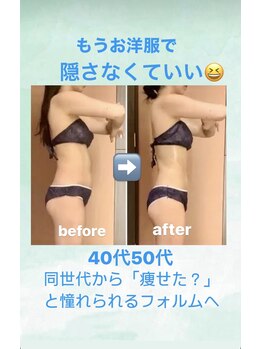 サロン ド プリヴェ(Salon de PRIVE)/もうお洋服で隠す必要ない身体へ