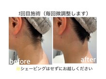 ハーチ(8)の雰囲気（【大人気のデザイン脱毛】後悔のしない脱毛はハーチで。）