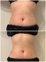 シェリール(CHIRIEUR)/実感できるから継続できる