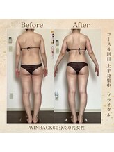 エソール(essor)/ブライダル前の駆け込みも！