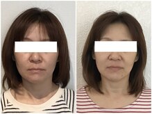 美容整体 ウェリナ 蟹江院/小顔矯正/骨盤矯正/美脚サロン