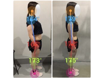 ピラネス 広島並木店(PlLA NESS)/2か月で姿勢改善+ダイエット成功