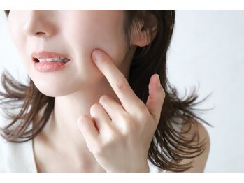 エス センダイ(S SENDAI)/春先の肌荒れの方増加中！