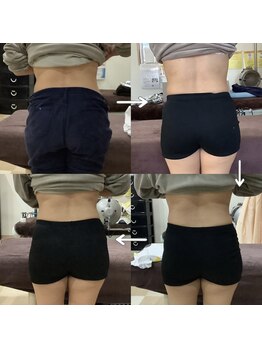 トータルヘルスビューティーカズ(TotalHealthBeauty KAZU)/【ダイエット・痩身】光の森