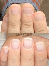 マリーロール 梅田店(Marie Laure)/自爪育成/深爪矯正/ネイルケア