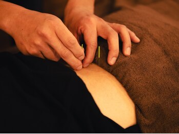 リフージ 大岡山院(RE.FUGE)/はり