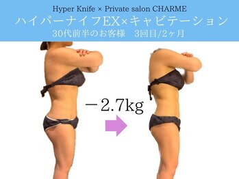 シャルム(charme)/ハイパーナイフEX痩身
