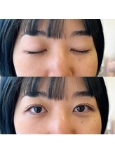 ニューム(nium)/ラッシュリフト上下