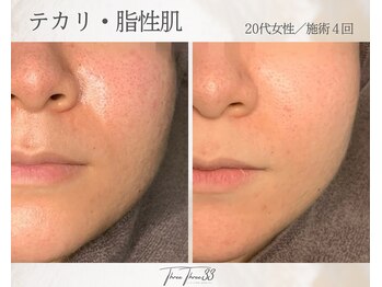 スリースリー(THREE THREE)/テカリ・脂性肌ケア