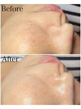 ブラックボックス(BLACK BOX)/30代女性のお客様