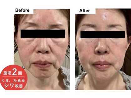 リュクシー(LuxeY)の写真