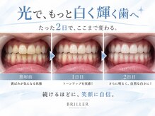 ブリエ 久屋大通店(BRILLER)の雰囲気（【大人女性、男性に人気No1】医療提携ジェルを使用で圧倒的効果）