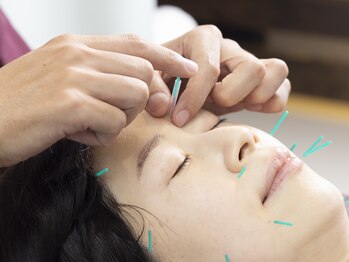 かえで鍼灸整体院/美容鍼★