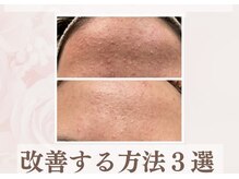 ソワン(Vi Soin)の雰囲気（肌質改善されたい方是非お試し下さい。）