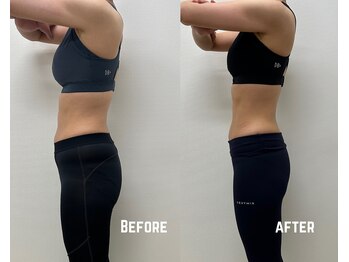 タイコ接骨院 栄本店/パーソナルトレーニング+整体