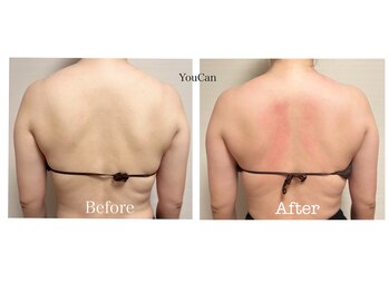 ユーキャン(You Can)/ハイパーナイフ痩身