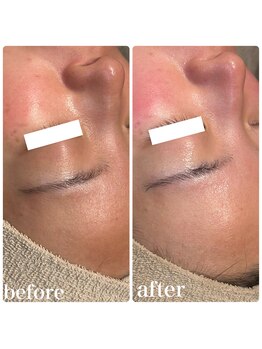 ディオーネ 春日井勝川店(Dione)/マーメイドセルトリートメント