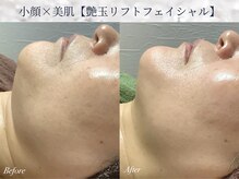 エミルカ 仙台(EMILUCA)の雰囲気（リフトアップや、シミシワ・たるみにお悩みの方に◎）