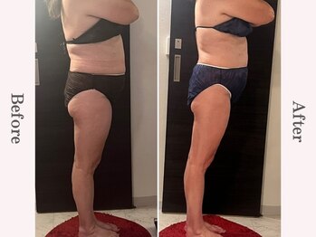 ビューティースタジオ エイワン(A1)/