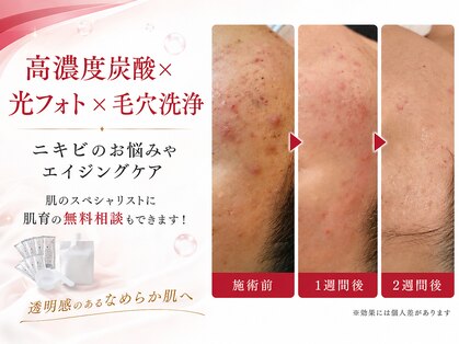 クリア(CLEAR)の写真