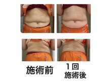 鍼灸サロンオランジュ 高槻富田院/