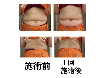 鍼灸サロンオランジュ 高槻富田院/