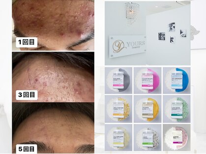 ユアーズ ビューティー(YOURS beauty)の写真