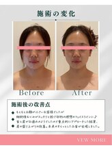 アルメ(Alume)/全身調整×快眠脳ヘッドリンパ