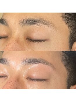 アルム(a'lm)/メンズアイブロウ/ワックス脱毛