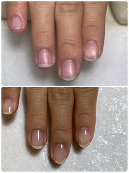 8ヶ月の継続自爪育成