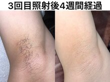 なちゅらる 苫小牧/ワキ