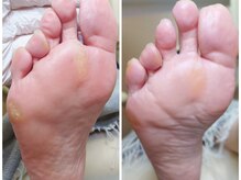 リゼラアンドコー 浦安店/ドイツ式フットケア専門店