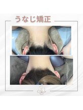 ミース 宮崎店/うなじ矯正の効果