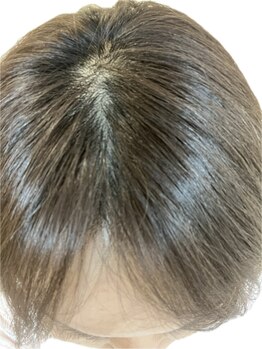 リセル(Recell)/育毛促進ケア