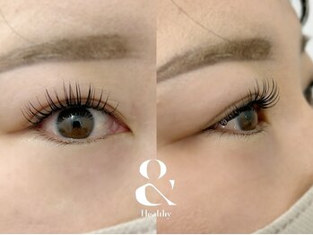 ムニ(muni)/&healthy【アンドヘルシー】