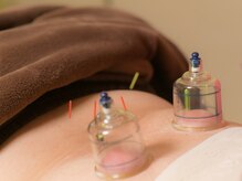 はるもにあ/鍼灸×カッピング《背中》