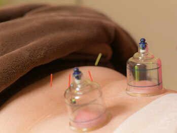 はるもにあ/鍼灸×カッピング《背中》