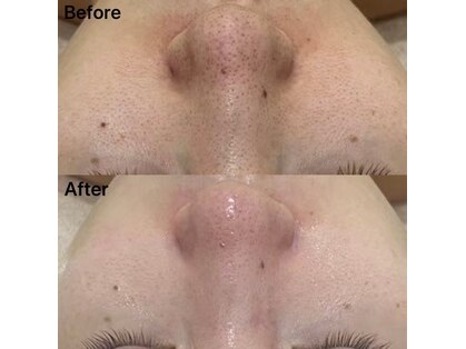 リンダ(Rinda)の写真