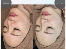 カメリア 新松戸(Camellia)/ バレンタインキャンペーン