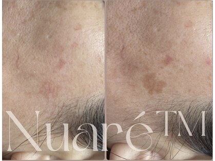 エスビーエス オキナワ(SBS OKINAWA)の写真