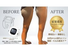 なまえのないエステサロン
